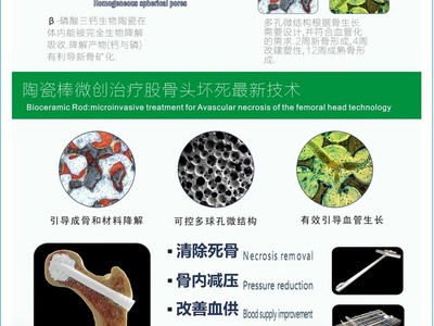 贝奥路多孔生物陶瓷产品特征微创治疗