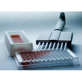 牛可溶性白细胞分化抗原86(B7-2/sCD86)ELISA测试盒_上海瑞齐生物技术